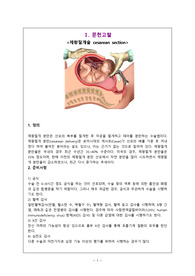 모성케이스-분만실실습 c/s