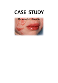 아동간호학 가와사키 CASE 문헌고찰 진단