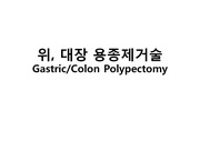위 대장 용종 제거술 / G.polypectomy & C.polypectomy
