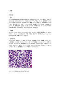 비세포림프종 case study, 비세포림프종 간호진단, 림프종 간호진단