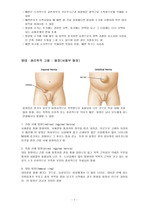 전대어린이병원 신생아 서혜부 탈장수술비용/필요한 보험서류/주말 퇴원