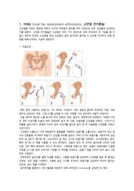 TKRA, THRA 고찰