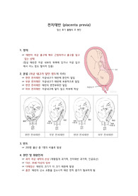 질병고찰 전치태반 간호