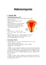 Adenomyosis 자궁선근증 케이스