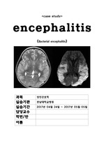 뇌염 [Encephalitis CASE STUDY]