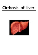 성인간호학 케이스 LC liver cirrhosis 간경화