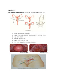 Total abdominal Hysterectomy (TAH) 자궁근종 수술과정, 수술실CASE A++++!!!