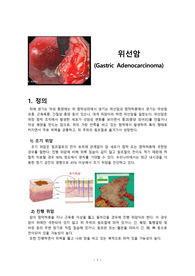 [A+ case] 성인간호학(수술실) - 위암 문헌고찰/수술적 치료 및 수술과정