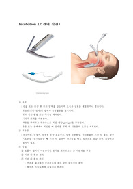 기관내 삽관의 정의 및 목적과 방법