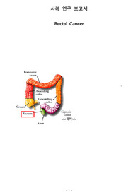성인간호학 실습 직장암 케이스스터디 rectal cancer case study (A+)