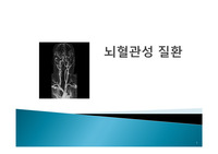 뇌혈관성 질환