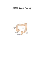 직장암 케이스 성인 간호학 A+ 간호진단 3개