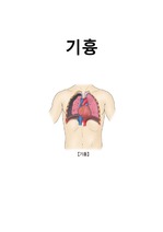 기흉 간호과정