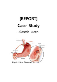 [위궤양, Gastric ulcer] A+ 받은 CASE STUDY 케이스 스터디 위궤양, gastric ulcer 간호진단 5개 중 우선순위 두개 간호과정 2개 급성통증, 오심, 체액불균형, 출혈위험성, 불안