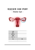 [A+]여성간호학 난소낭종(Ovarian Cyst) 스터디케이스 - 간호진단4개, 간호과정4개!!