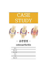성인간호학 골관절염 + TKRA 케이스스터디 (간호진단3개) 급성통증, 수면장애, 감염위험성