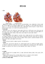 울혈성 심부전 case study