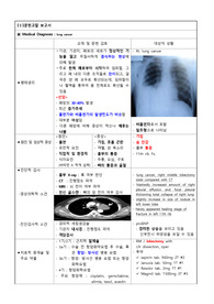 폐암(lung cancer) case study