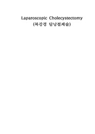 복강경 담낭절제술(laparoscopic cholecystectomy)case study 수술과정, 수술기구(OR3번봄)