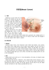 모성간호학실습/케이스/간호과정/모성실습 유방암 케이스