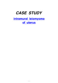A++ 받은 intramural leiomyomaof uterus 자궁근종 간호과정(case study)입니다.