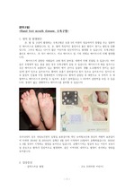 Hand foot mouth disease, 수족구병(HFMD) 케이스