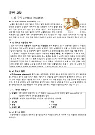 뇌경색 문헌고찰입니다.