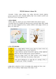 파킨슨병 정리 - 원인과 병태생리, 증상, 약물요법과 간호, 간호진단과 중재