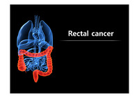 rectal cancer