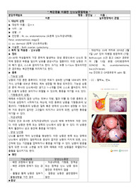 &lt;난소 낭종 절제술&gt; 실제로 수술 보고 작성한 내용임!