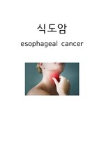 식도암, esophageal cancer