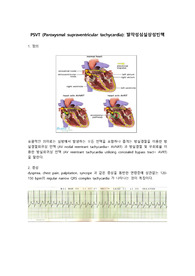 PSVT 병태생리 및 응급간호