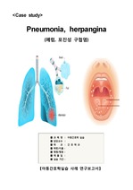 A+ 아동간호학실습 케이스) Pneumonia, herpangina(폐렴, 포진성 구협염), 진단3개