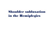 shoulder subluxation, hemiplegia, 편마비