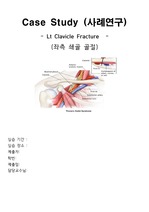 성인간호학 쇄골골절 케이스(진단3개)