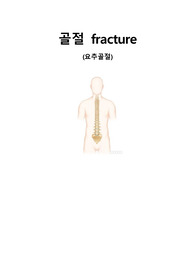 성인간호학 - 골절 CASESTUDY, 골절 케이스스터디, 간호진단, 간호과정, 간호수행, 간호평가