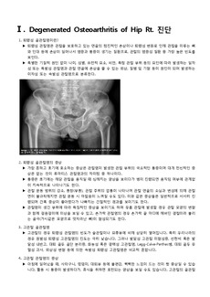 퇴행성 골관절염 진단과 인공고관절대상자의 수술 전후 간호 (시뮬과제)