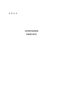 vertebroplasty, kypoplasty 정형외과 기초자료