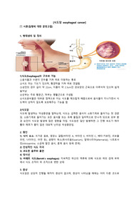 [성인간호학 A+ 식도암 간호과정 CASE STUDY] 침습적 시술과 관련된 급성통증