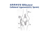 외측측부인대염좌(Lateral Collateral Ligament(LCL) Sprain)