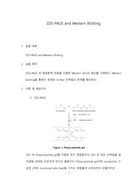 포항공대 화학생명공학실험[포스텍 A]Pre-Report (SDS-PAGE and Western Blotting)