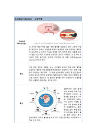 [성인간호학] A+뇌경색 케이스