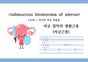 Submucous leiomyoma of uterus - LAVH -복강경 자궁 적출술 -자궁 점막하 평활근종 - 자궁근종