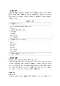 간질 워드클래스