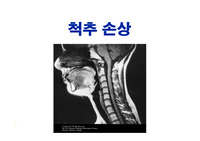 척수손상