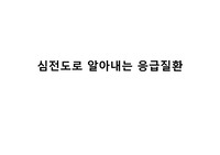 심전도로 알아내는 응급질환