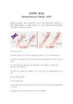 동정맥루 형성술 수술과정, Arteriovenous Fistula, AVF Procedure, OP procedure