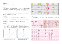성인간호학과제 심근경색(myocardiac infarction)
