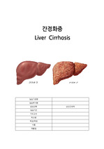 간경화,liver cirrhosis LC A+ 받은 케이스 성인간호 실습