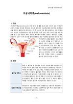 자궁내막증(endometriosis) 문헌고찰
